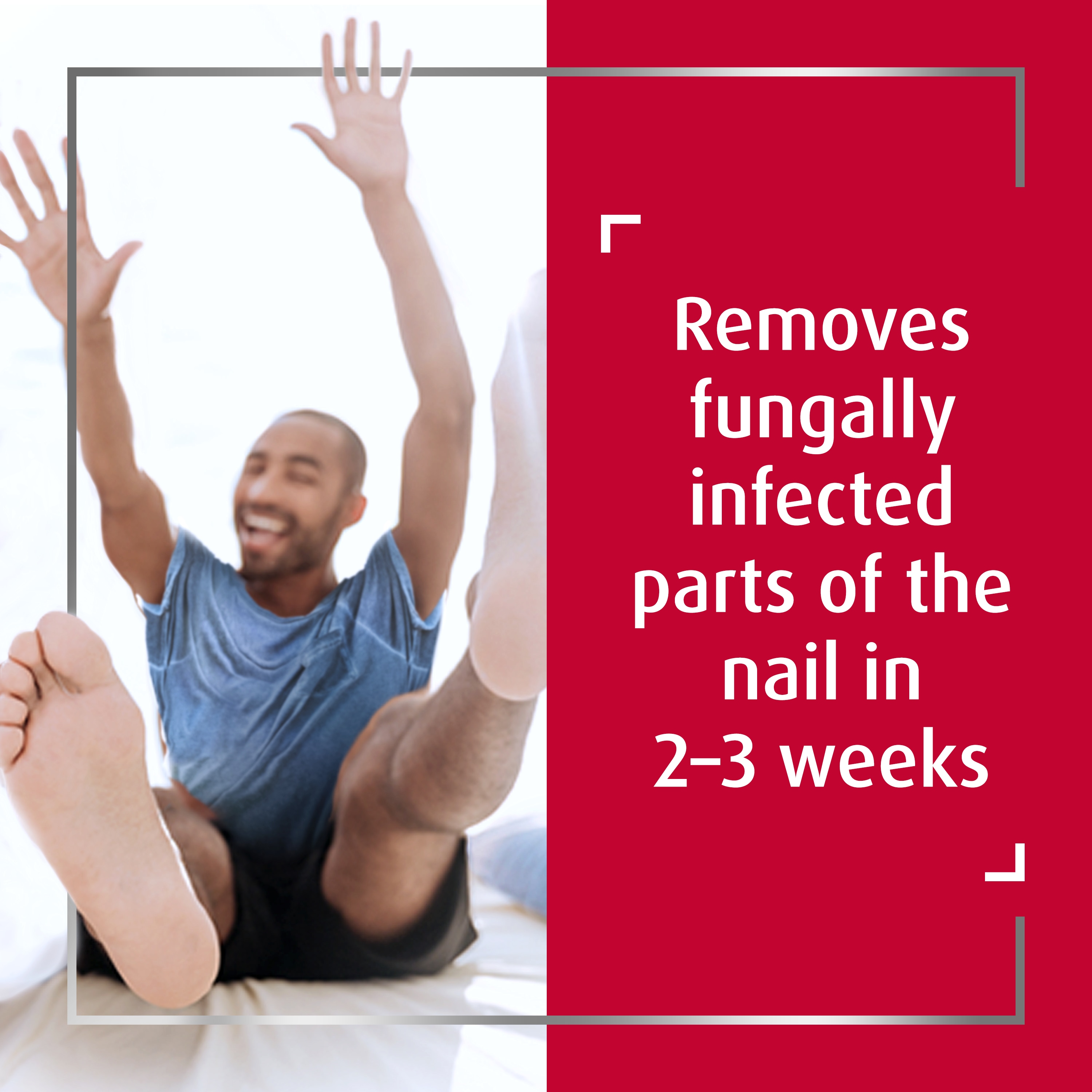 Young fashionable man in confident pose, with caption removes fungally infected parts of the nail in 2-3 weeks